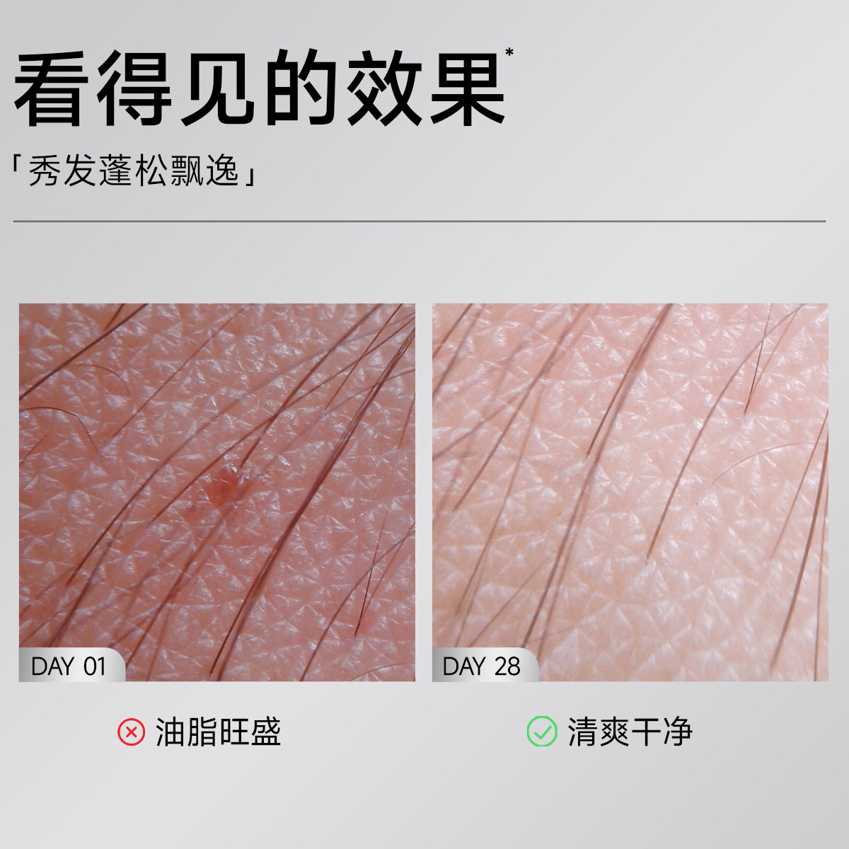 弹动多肽角蛋白生姜洗发水洗头膏控油防断蓬松品牌正品官方旗舰店