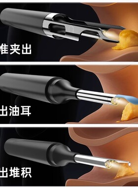 可视掏耳勺朵神器专业采