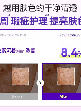 isntree紫色洋葱去角质提亮肤色棉片补水保湿200ml