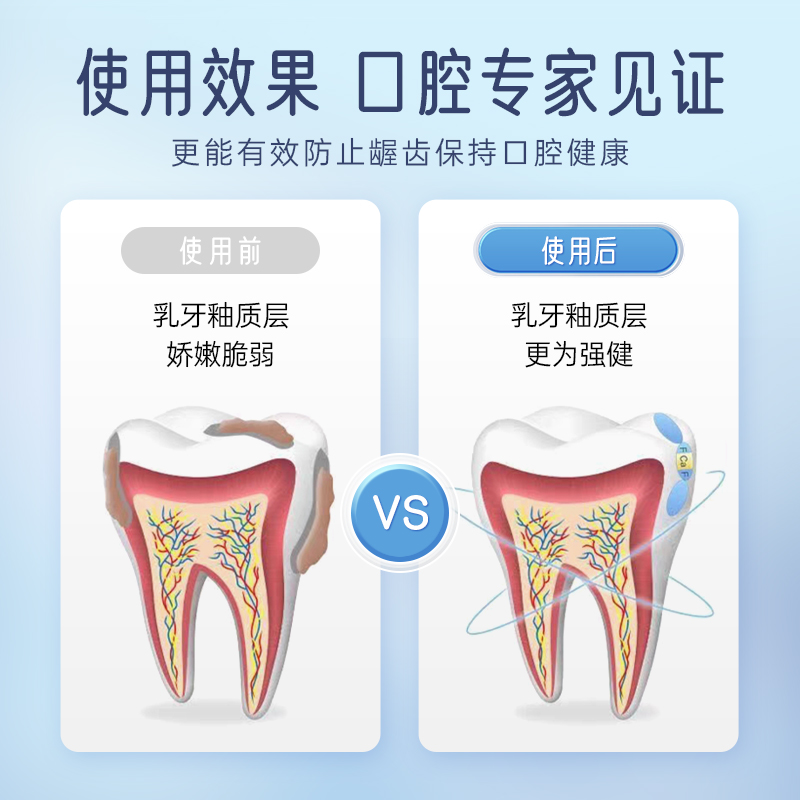 普迈迪口腔防蛀膏宝宝防蛀牙防龋齿固齿封闭牙窝沟点隙儿童型xu - 图2