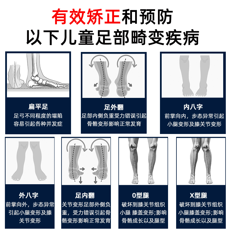 儿童扁平足矫正凉鞋足外翻纠正器医用内外八字足弓机能鞋垫XO型腿 - 图3