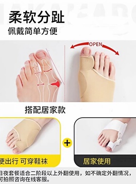 【医生推荐】拇外翻矫正可穿鞋