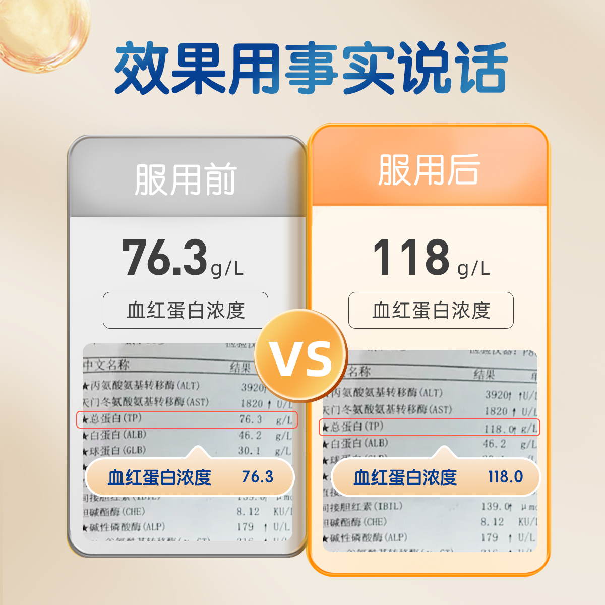 【小田研究社】1.0优弗迪红颜铁补铁女性补气养血铁剂孕妇铁元素