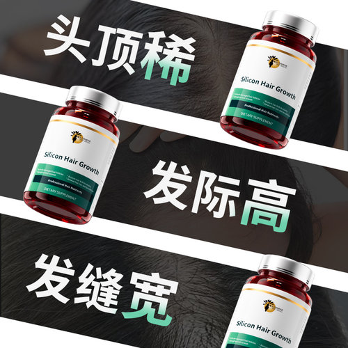 【发量惊人】瑟琳奇何首乌生物素角蛋白养发密发防脱男女通用 - 图2