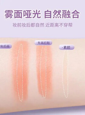 肿眼泡隐形蕾丝单面双眼皮贴
