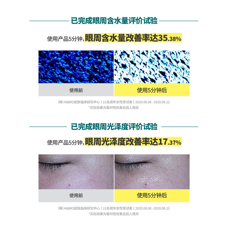  goodal果达儿海外眼膜