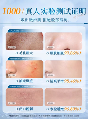 欧橘水杨酸爽肤水补水保湿收毛孔