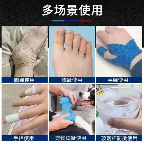 Ручка с крышкой горшка против артифакта горшки с устойчивыми к горшкам