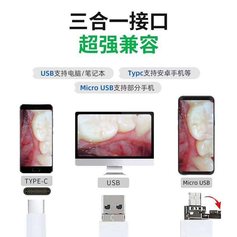 可视口腔内窥镜手机高清摄像头观察仪家护理检查镜牙科专用检测镜
