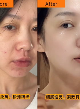 小众轻奢|黑/白熬夜双抗精华面膜