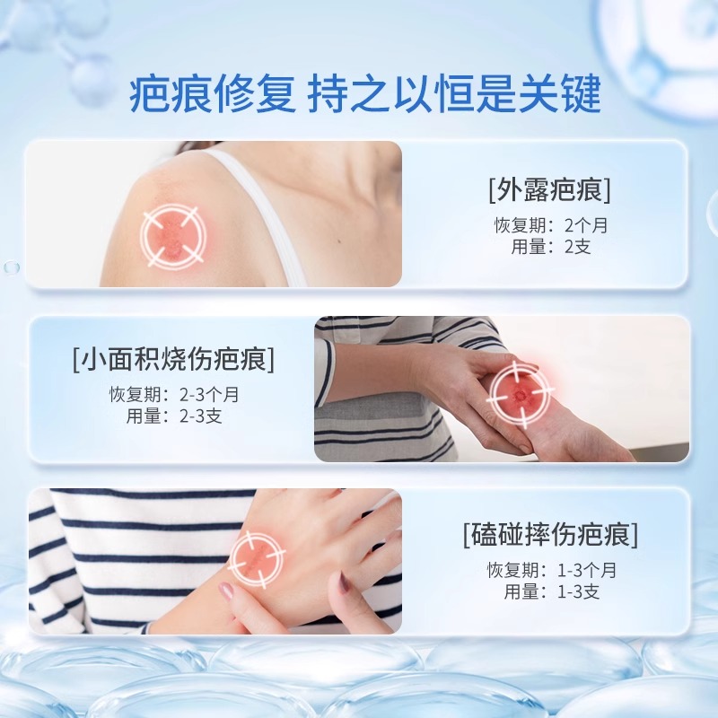 Dermatix倍舒痕医用硅酮凝胶祛疤膏去疤痕修复官方正品成人儿童 - 图3