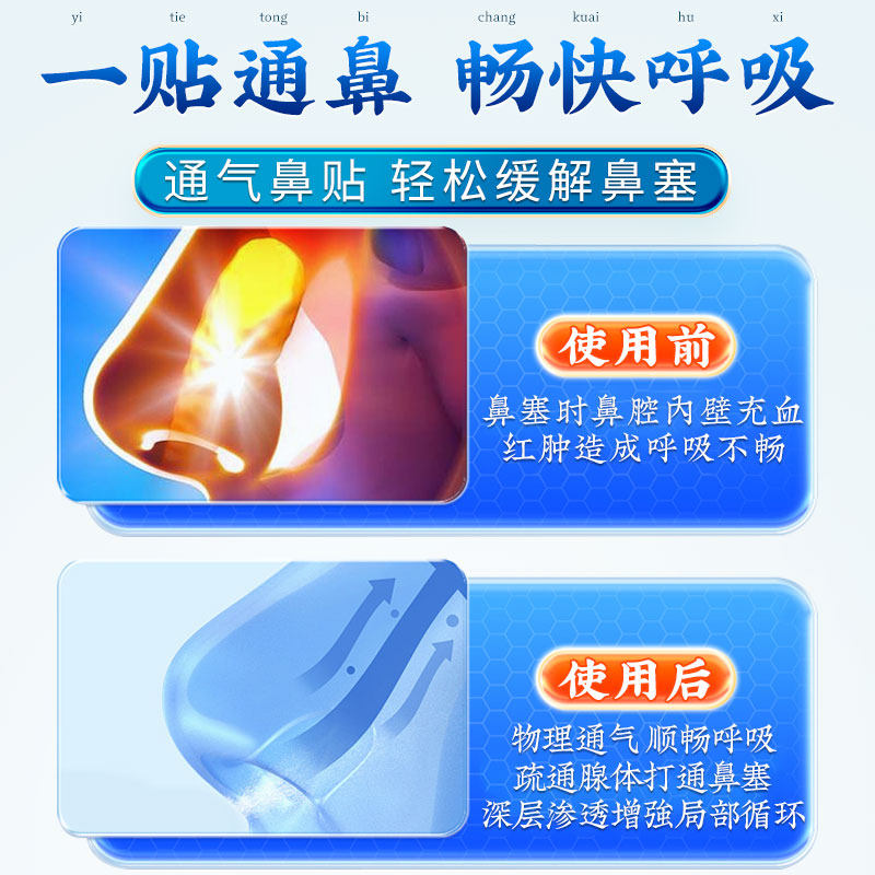 白云山艾草鼻通贴儿童通气鼻贴鼻塞通鼻神器鼻贴过敏性鼻成人炎贴,淘宝优惠券,粉丝福利购,淘宝优惠卷