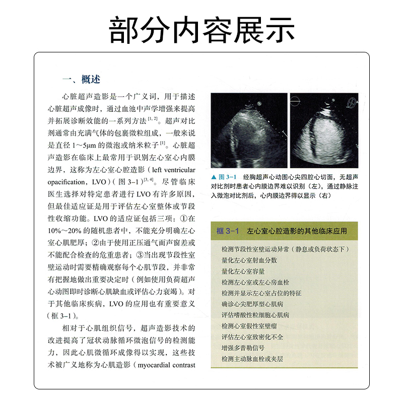 【书】Braunwald心脏病学超声心动图精要学习超声心动图理论和基本知识 宋海波唐红刘进主译中国科学技术出版社书籍 - 图2