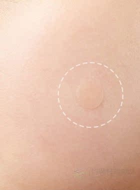 Pimple-Patch Hydrocolloid Clear Waterproof