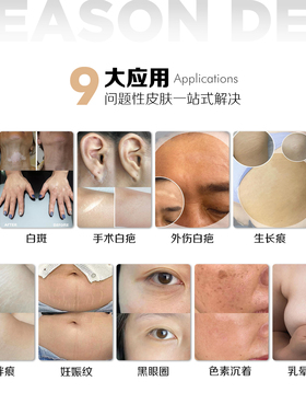 季黛肤色重建套组皮肤疤痕遮盖妊娠纹生长纹肥胖纹赠全套教学视频