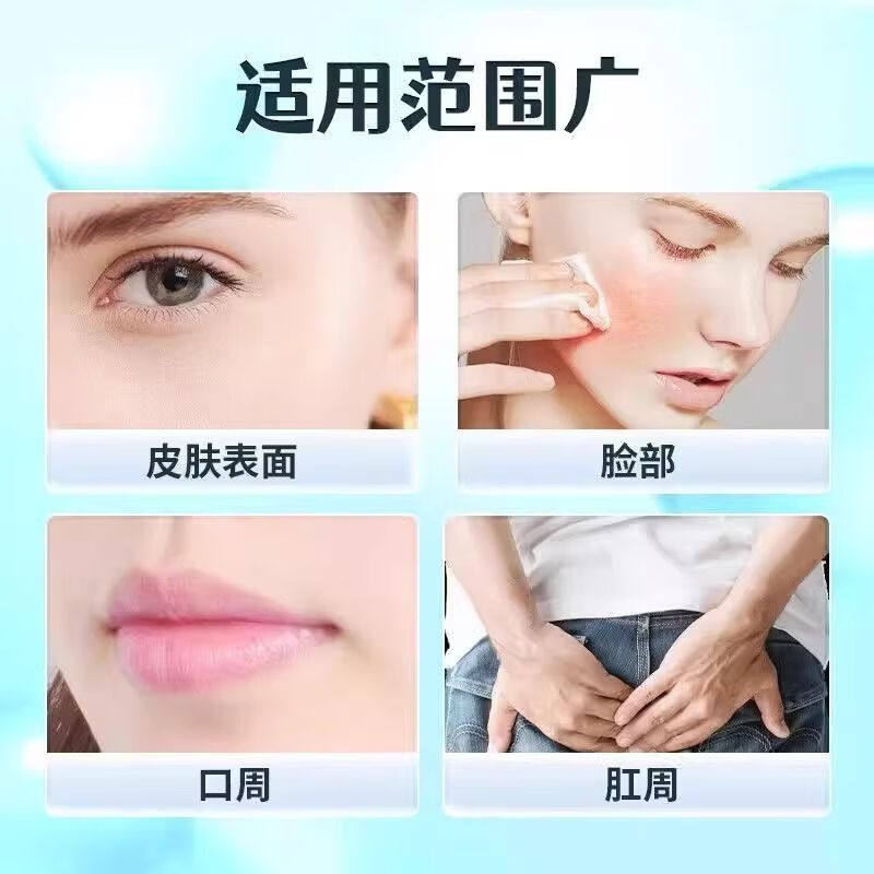 红霉素软膏外用脓包痤疮皮肤病烧溃疡感染抗菌伤官方旗舰店正品药,淘宝优惠券,粉丝福利购,淘宝优惠卷