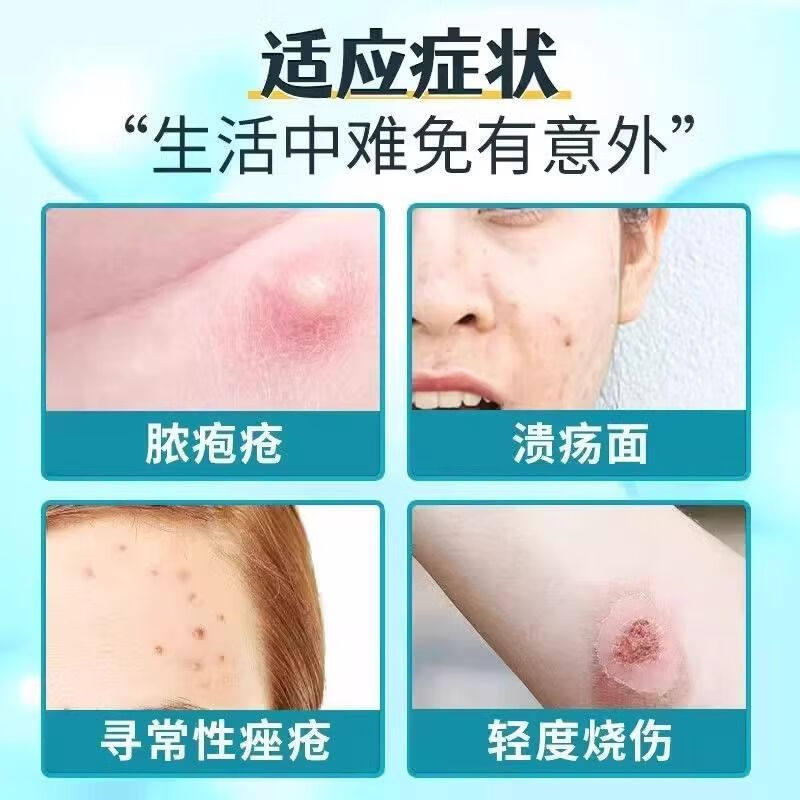 红霉素软膏外用脓包痤疮皮肤病烧溃疡感染抗菌伤官方旗舰店正品药,淘宝优惠券,粉丝福利购,淘宝优惠卷