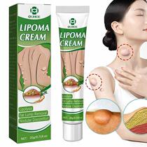 Crème de déliriation efficace lipoma Lipolyse Crème Remobal