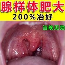 Gonad-like body hypertrophy Traditional Chinese medicine post children sleeping Zhang mouth respiratory non-ventilation nasal plug conditioning Cosmetic Orthodontic paste