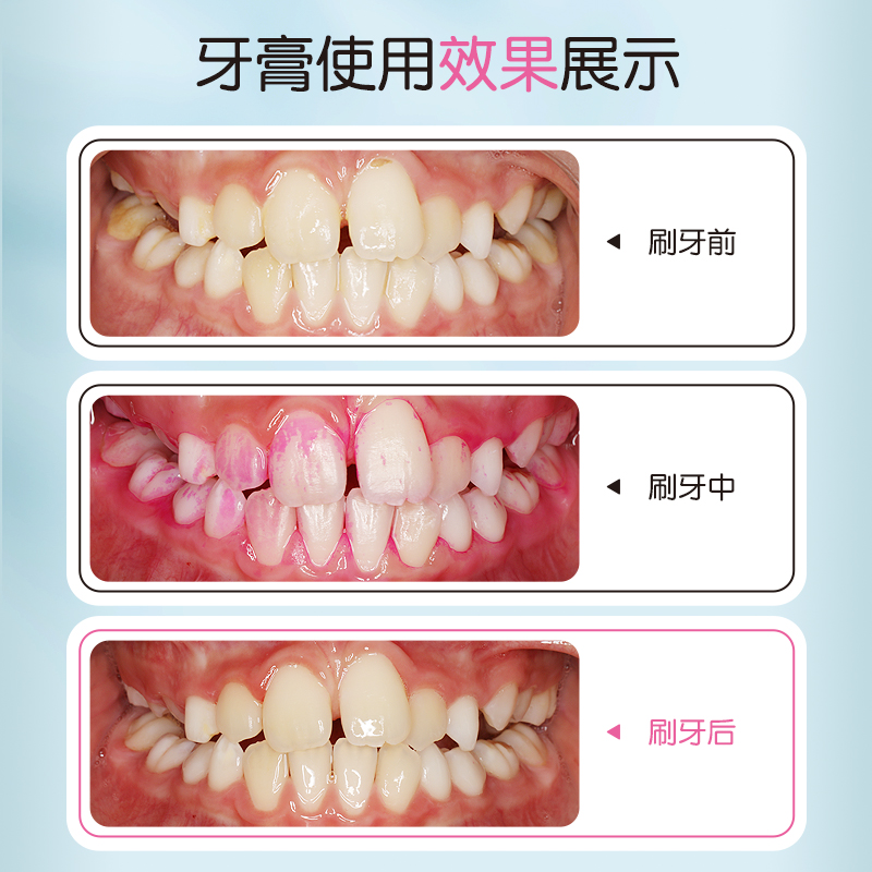 牙高医生儿童菌斑可视牙膏含氟显色牙菌斑去牙黄去牙黑水果草莓味-图3