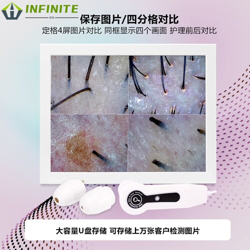 厂家美容院15寸平板头皮检测仪高清一体机智能毛囊毛发分析仪 - 图1