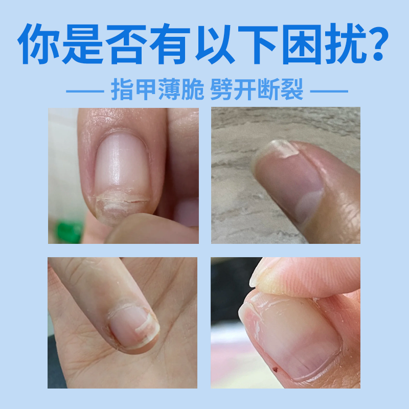 指甲劈了断裂劈裂手指甲盖受伤边缘裂口开裂护甲套保护贴医用级JW,淘宝优惠券,粉丝福利购,淘宝优惠卷