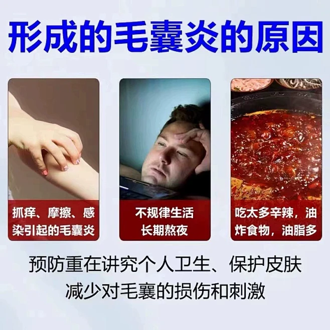 大腿腿上毛囊炎腿部毛孔堵塞疏通毛囊鸡皮肤医用退热凝胶喷雾剂JW,淘宝优惠券,粉丝福利购,淘宝优惠卷