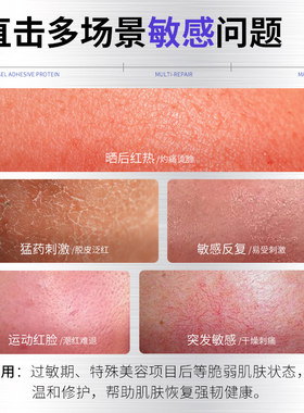 贝护妍敏感肌舒缓修护面膜