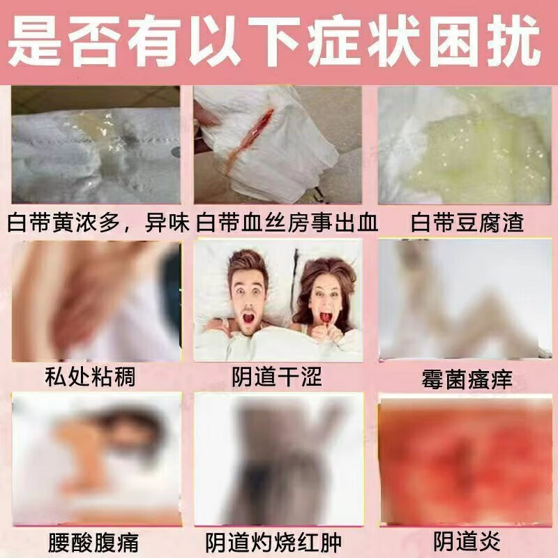 阴道炎妇科炎症特专效用药盆腔炎消炎药口服宫颈炎糜烂妇炎康片zz