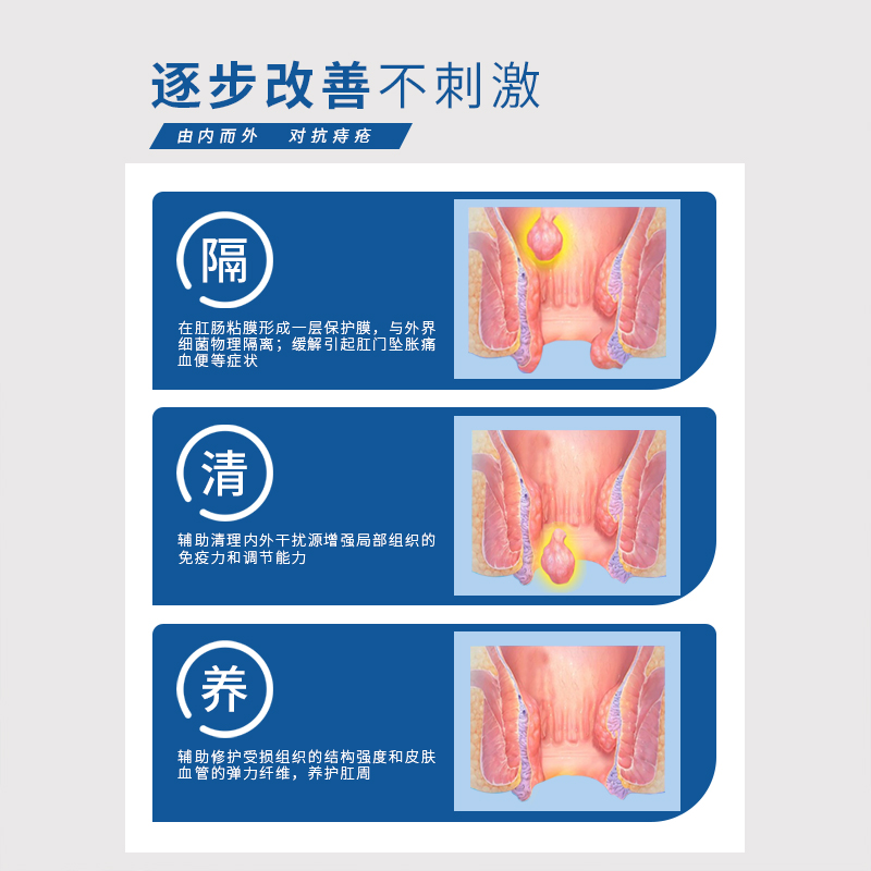 七维健康国创阿利美卡波姆痔疮凝胶内外混合肉球肛门脱落充血便秘 - 图1