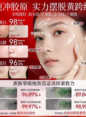 olay玉兰油大红瓶面霜50g