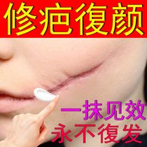 Scalding Special medicine Ointment Recessed pimple Pox Imprint Gestational postoperative scar hyperplasia repair Desalinated Cream God