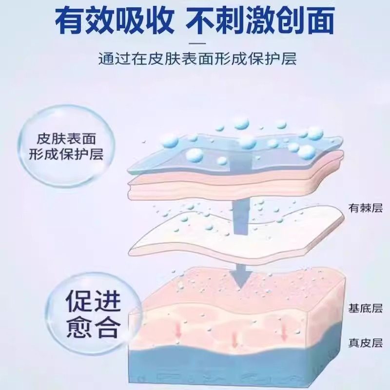 手指关节癣手癣脱皮干裂真菌感染湿疹手足硬皮止痒药监备案药膏LL,淘宝优惠券,粉丝福利购,淘宝优惠卷