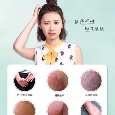 香港同济大药房苗方膏阴囊潮湿皮肤瘙痒官方正品