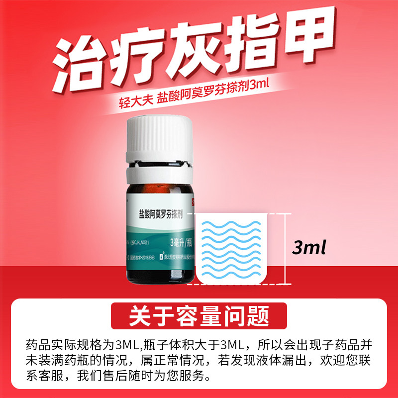  轻大夫癣症