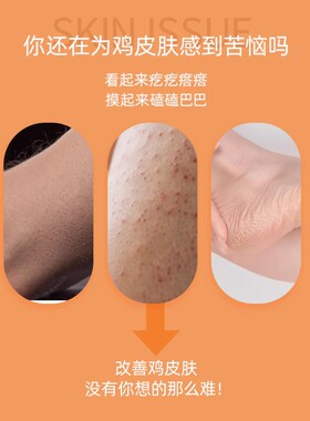 帕玛氏可可脂身体乳去鸡皮3瓶装