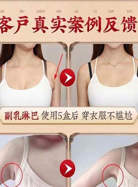 新品【200%管用】淋巴结消散结膏脖子肿专科用疏通W神器副乳去消