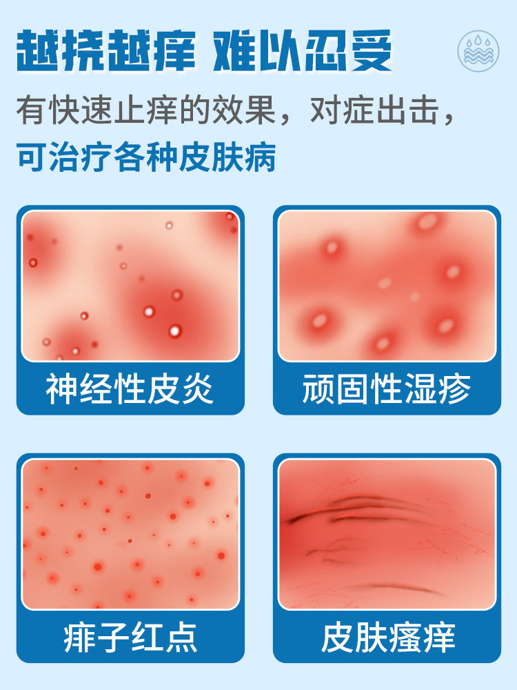 糠酸莫米松软膏乳膏神经性皮炎外用膏治疗湿疹止痒成人湿疹抗炎-图1