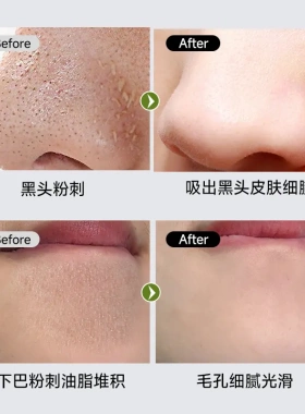 金妮雅鼻膜去黑头撕拉面膜男女改善毛孔清洁黑头粉刺温和不刺激