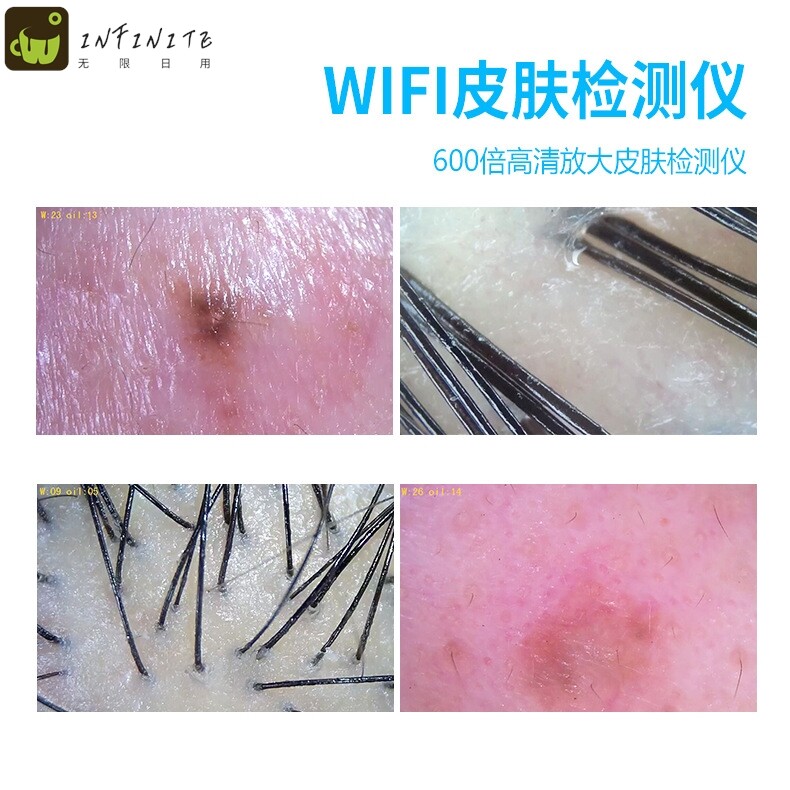 智能分析毛囊检测头皮毛发放大高清wifi皮肤检测仪手持皮肤分析仪