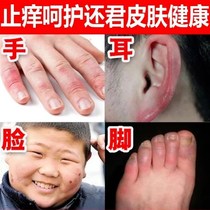 Buy 2 send 1 Miao paving dragon Snake Cream Wet Itching Mosquito Repellent Insect Bites Remove Body Itching Prickly prickly prickly skin Skin Stop Itch Cream