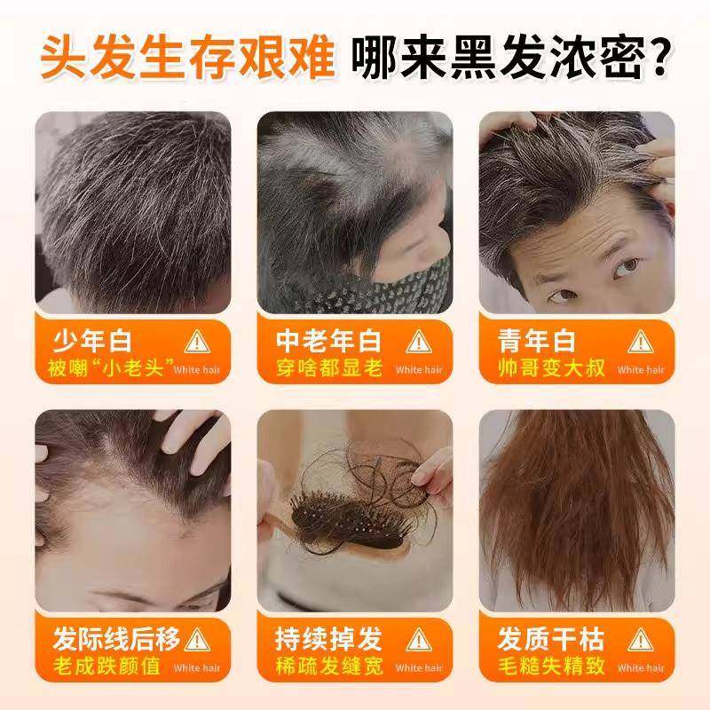 卡西奈维生素b维生素d3白发脱发生物素黑发养发男女,淘宝优惠券,粉丝福利购,淘宝优惠卷