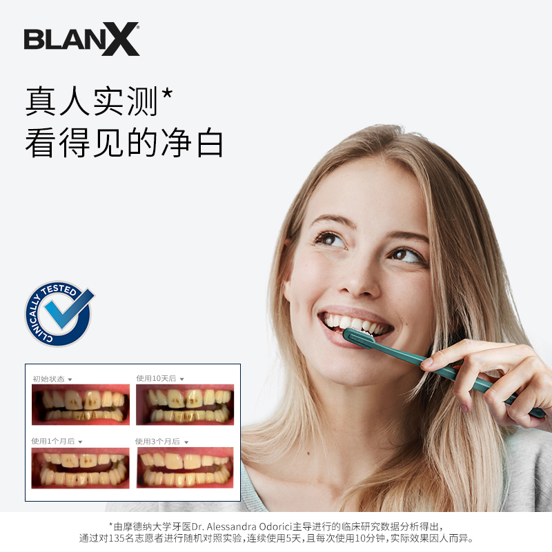 意大利Blanx/倍林斯活性炭深层净白牙膏75ml/盒活性炭qu牙齿黄-图2