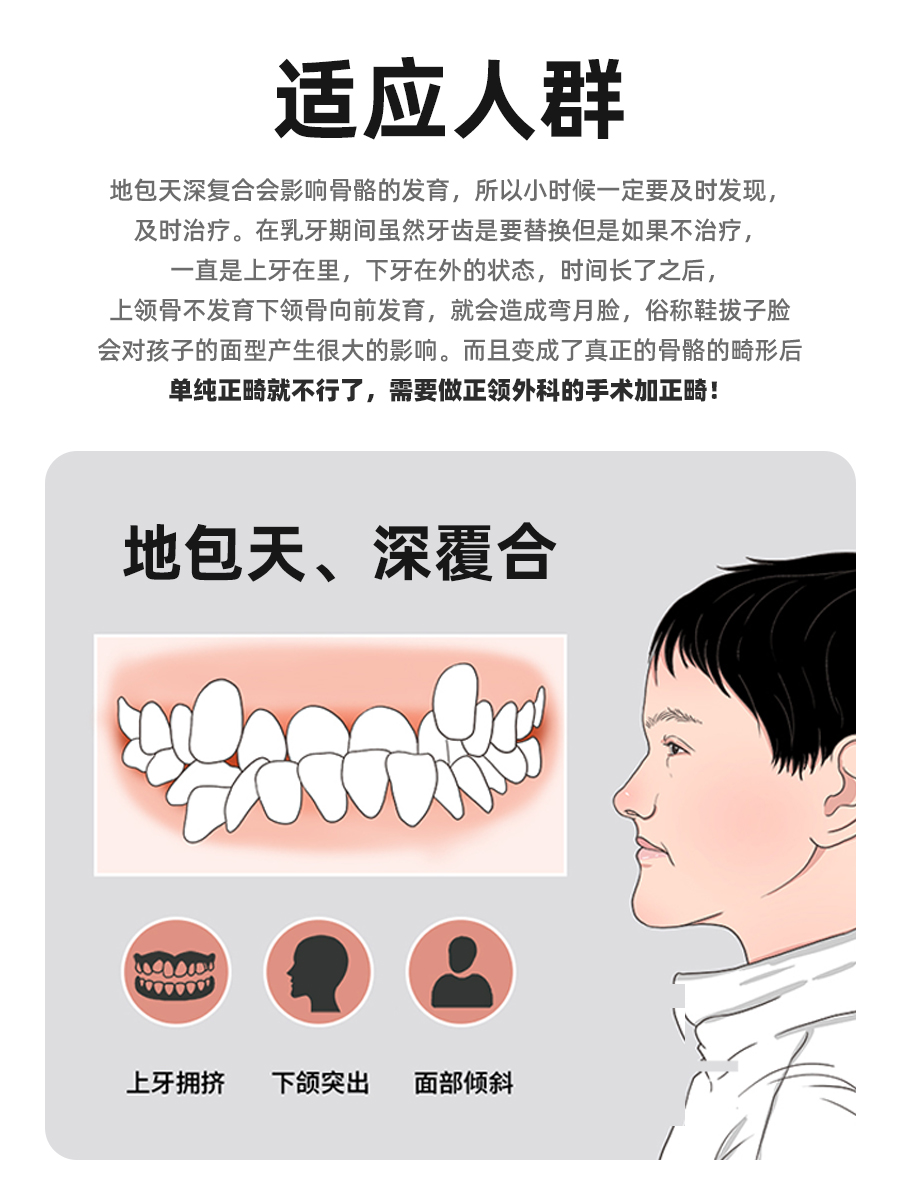 法兰克3儿童牙齿隐形矫正器地包天龅牙牵引扩弓器深覆合反颌正畸 - 图3