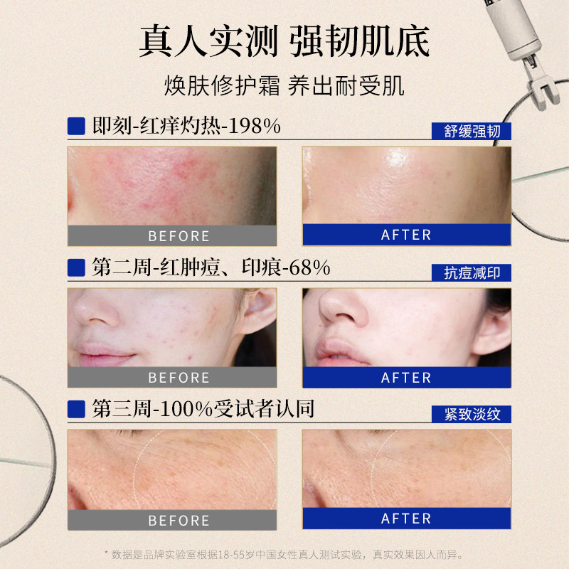 B12面霜多效修护霜淡化色素痘印保湿晒后脸部舒缓瑞士面霜