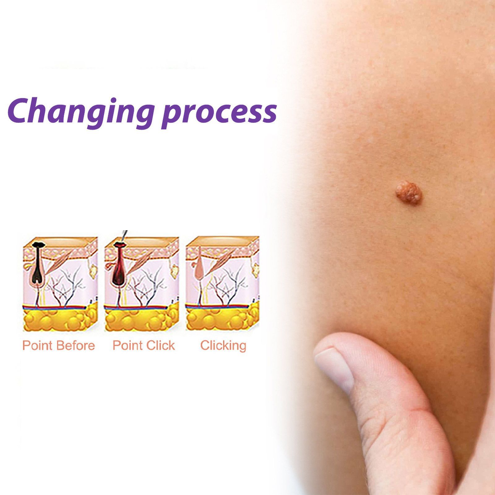 Skin cleaning solution cleans the body, desalinates dull ski - 图0