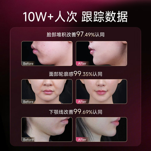 【院线同款】vitavea法国小V脸丸提拉紧致白加黑防脸部下垂水肿 - 图3