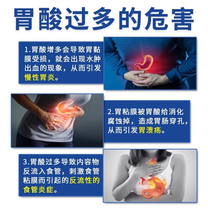 奥美拉唑肠溶胶囊正品胃药胃酸过多反酸烧心胃不舒服胃炎专用药
