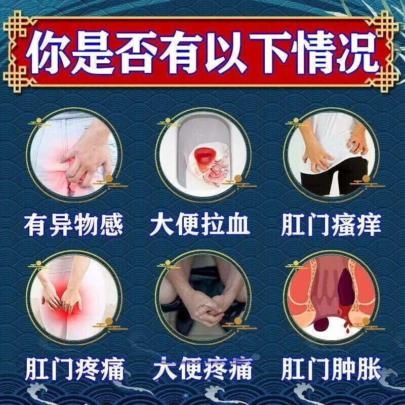 马应龙痔疮膏正品治痔疮特疼痔疮有肉球内痔外痔混合痔出血效药膏