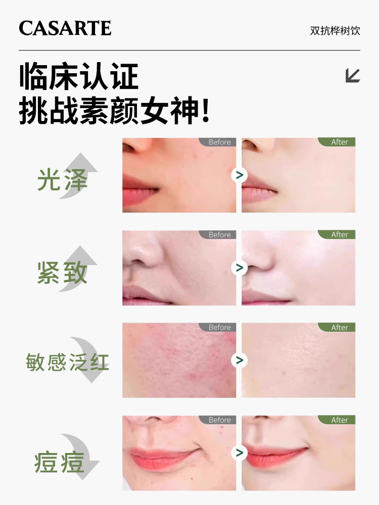 Casarte【美国进口】双层抗性桦树植物原液天然营养液10ml*12